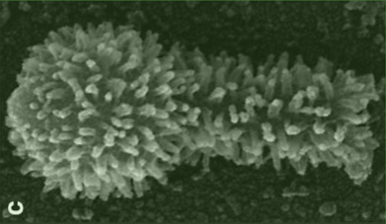 Tupan virus under light microscope